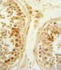 Secreted Frizzled Related Protein 1 (SFRP1) Antibody