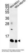 Cornifin B (SPRR1B) Antibody
