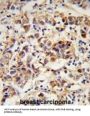 Cornifin B (SPRR1B) Antibody