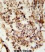 Acrosin (ACR) Antibody