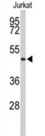 Acrosin (ACR) Antibody
