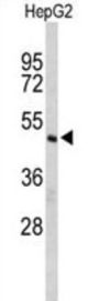CASP8 And FADD Like Apoptosis Regulator (CFLAR) Antibody