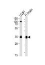 Guanine Nucleotide Binding Protein (G Protein), Alpha Activating Activity Polypeptide O (GNAO1) Antibody
