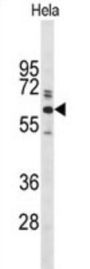Glypican-1 Antibody