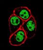 Parafibromin (CDC73) Antibody