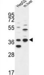 Short-Chain Dehydrogenase/Reductase 3 (DHRS3) Antibody