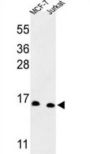 Small Nuclear Ribonucleoprotein D3 Polypeptide (SNRPD3) Antibody