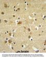GABRD Antibody