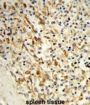PCAT1 Antibody