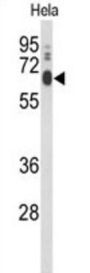 PCAT1 Antibody