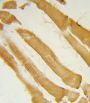 Inositol-Trisphosphate 3-Kinase C (ITPKC) Antibody