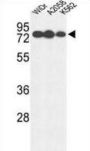 Beta-Glucuronidase (GUSB) Antibody