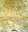 U3 Small Nucleolar Ribonucleoprotein Protein IMP4 (IMP4) Antibody