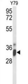 U3 Small Nucleolar Ribonucleoprotein Protein IMP4 (IMP4) Antibody