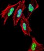 T-Box Protein 1 (TBX1) Antibody