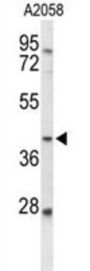 3-Galactosyl-N-Acetylglucosaminide 4-Alpha-L-Fucosyltransferase FUT3 (FUT3) Antibody