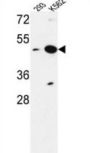NUPL2 Antibody