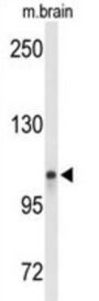 Lon Peptidase 2, Peroxisomal (LONP2) Antibody
