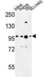 B-Cell Lymphoma/Leukaemia 11A (BCL11A) Antibody