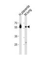 Cyclic AMP-Responsive Element Binding Protein 3 Like Protein 2 (CREB3L2) Antibody