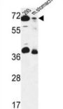ERF3B Antibody