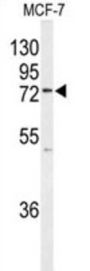 E3 UFM1-Protein Ligase 1V (K0776) Antibody