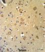 Leucine Rich Repeat Transmembrane Neuronal 1 (LRRTM1) Antibody