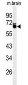 Leucine Rich Repeat Transmembrane Neuronal 1 (LRRTM1) Antibody