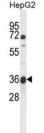 MOCO Sulphurase C-Terminal Domain Containing Protein 1 (MOSC1) Antibody