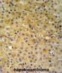 NADH Ubiquinone Oxidoreductase Subunit A10 (NDUFA10) Antibody
