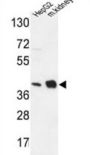 NADH Ubiquinone Oxidoreductase Subunit A10 (NDUFA10) Antibody