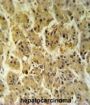 NADH Ubiquinone Oxidoreductase Core Subunit S2 (NDUFS2) Antibody