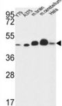 NADH Ubiquinone Oxidoreductase Core Subunit S2 (NDUFS2) Antibody
