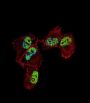 Zinc Finger Protein 202 (ZNF202) Antibody