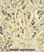 Zinc Finger Protein 202 (ZNF202) Antibody