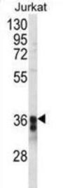 TM173 Antibody