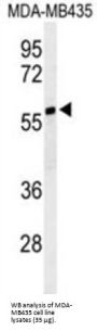 Nuclear Prelamin A Recognition Factor Like (NARFL) Antibody
