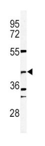 DFFB Antibody