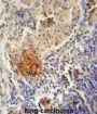 TYROBP Antibody