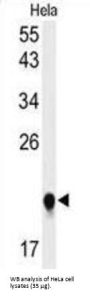U3 Small Nucleolar Ribonucleoprotein Protein IMP3 (IMP3) Antibody