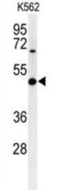 Galactosylgalactosylxylosylprotein 3-Beta-Glucuronosyltransferase 1 (B3GAT1) Antibody