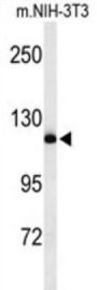 Neural Precursor Cell Expressed, Developmentally Down-Regulated 4, E3 Ubiquitin (NEDD4) Antibody
