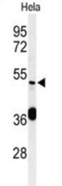 DEAD (Asp-Glu-Ala-Asp) Box Polypeptide 49 (DDX49) Antibody