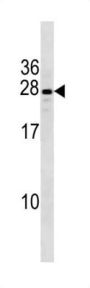 Protein PIH1D3 (CXorf41) Antibody