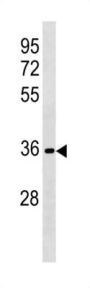 Ret Finger Protein-Like 3 (RFPL3) Antibody