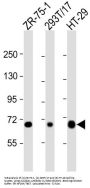 Sodium/Nucleoside Cotransporter 1 (SLC28A1) Antibody
