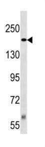 Tuberous Sclerosis Protein 2 (TSC2) Antibody
