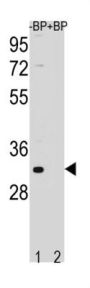 Calcium Homeostasis Modulator Protein 6 (FAM26F) Antibody