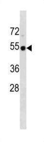 Cellular Tumor Antigen P53 (TP53) Antibody