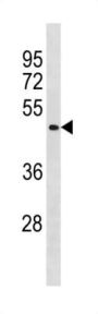 B-Cell CLL/lymphoma 6 Member B Protein (BCL6B) Antibody